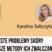 Częste problemy skóry